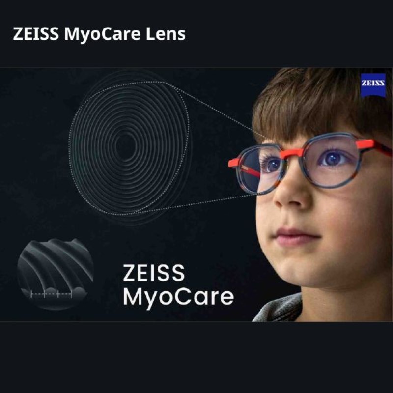 Tròng kính kiểm soát cận thị MyoCare Zeiss Cumaki